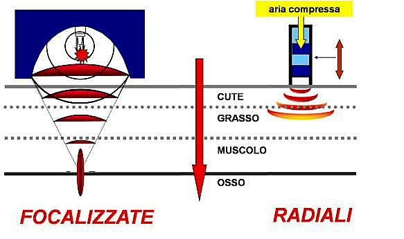 schema